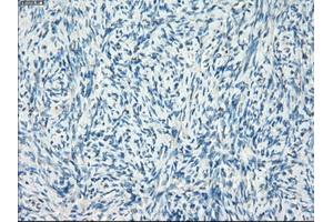 Immunohistochemical staining of paraffin-embedded colon tissue using anti-LTA4H mouse monoclonal antibody. (LTA4H antibody)