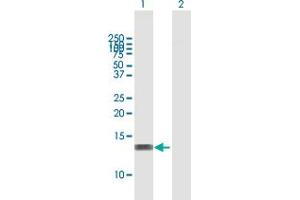 Western Blot analysis of RBBP6 expression in transfected 293T cell line by RBBP6 MaxPab polyclonal antibody. (RBBP6 antibody  (AA 1-118))