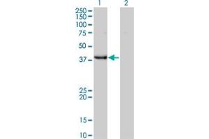 Western Blot analysis of UROD expression in transfected 293T cell line by UROD monoclonal antibody (M01A), clone 1G4. (UROD antibody  (AA 268-367))
