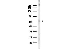 Western blot analysis of lysates from PC12 cells(LPS, 4h treatment), using C3orf31 Antibody at 1/1000 dilution.