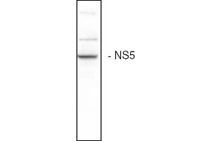 Western blot analysis of the HCV NS5B expression in Huh7 cells (Hepatitis C Virus antibody)