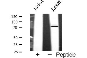 Western blot analysis of p73 expression in Jurkat cells