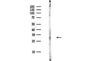 anti-Tumor Necrosis Factor (Ligand) Superfamily, Member 13b (TNFSF13B) (N-Term) antibody