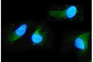 IF analysis of ADO using anti-ADO antibody (ABIN4886431). (ADO antibody  (AA 49-261))