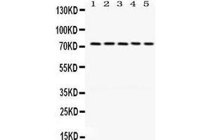 Western Blotting (WB) image for anti-LIM Domain Kinase 1 (LIMK1) (AA 599-634), (C-Term) antibody (ABIN3043411) (LIM Domain Kinase 1 antibody  (C-Term))