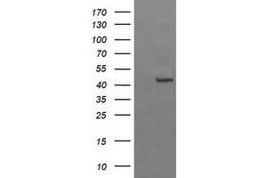 Image no. 1 for anti-butyrobetaine (Gamma), 2-Oxoglutarate Dioxygenase (Gamma-butyrobetaine Hydroxylase) 1 (BBOX1) antibody (ABIN1496816) (BBOX1 antibody)