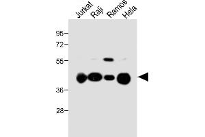 Western Blotting (WB) image for anti-HLA Class I Histocompatibility Antigen, alpha Chain G (HLAG) (AA 62-89) antibody (ABIN652888)