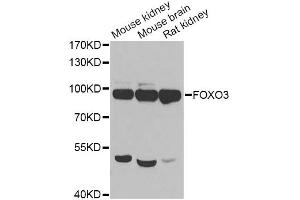 Western blot analysis of extracts of various cell lines, using FOXO3 antibody (ABIN5974623) at 1/1000 dilution. (FOXO3 antibody)