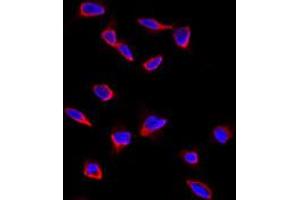 Immunofluorescence analysis of CD9 polyclonal antibody  in HeLa cells. (CD9 antibody  (Internal Region))