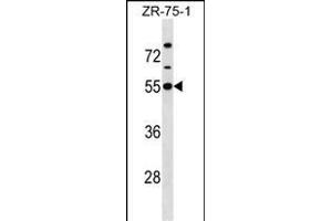 KCNJ1 Antibody (C-term) (ABIN1537138 and ABIN2850385) western blot analysis in ZR-75-1 cell line lysates (35 μg/lane). (KCNJ1 antibody  (C-Term))