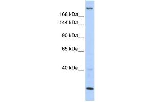 WB Suggested Anti-TNRC6B Antibody Titration:  0. (TNRC6B antibody  (N-Term))