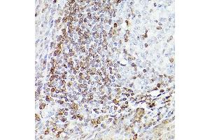 Immunohistochemistry of paraffin-embedded Human tonsil(400X) using Bcl-2 antibody (ABIN7265810) at dilution of 1:100 (40x lens). (Bcl-2 antibody)