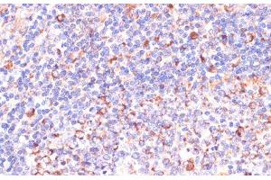 Immunohistochemistry of paraffin-embedded Human tonsil using VHL Polyclonal Antibody at dilution of 1:200 (40x lens). (VHL antibody)