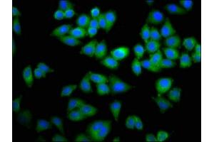 Immunofluorescence staining of Hela cells with ABIN7150346 at 1:100, counter-stained with DAPI. (TOP2B antibody  (AA 1400-1626))