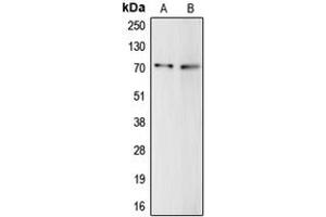 Western blot analysis of Complement C9 expression in HepG2 (A), THP1 (B) whole cell lysates. (C9 antibody  (Center))
