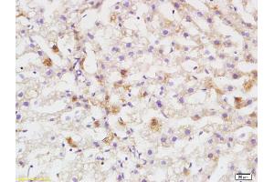 Formalin-fixed and paraffin embedded rat liver labeled with Anti DEPTOR/DEPDC6 Polyclonal Antibody, Unconjugated (ABIN1387597) at 1:200 followed by conjugation to the secondary antibody and DAB staining (DEPTOR antibody  (AA 56-170))