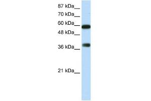 WB Suggested Anti-ARID3B Antibody Titration:  0. (ARID3B antibody  (C-Term))