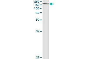 Immunoprecipitation of XPO5 transfected lysate using anti-XPO5 monoclonal antibody and Protein A Magnetic Bead , and immunoblotted with XPO5 MaxPab rabbit polyclonal antibody. (XPO5 antibody  (AA 1-280))