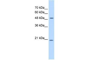 WB Suggested Anti-GCNT4 Antibody Titration:  0.