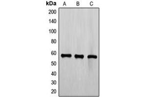 Western blot analysis of TEL expression in CCRFCEM (A), Jurkat (B), K562 (C) whole cell lysates.