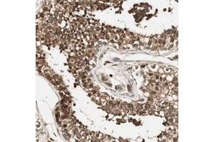 Immunohistochemical staining of human testis with CNOT4 polyclonal antibody  shows strong cytoplasmic positivity in cells of seminiferus ducts.