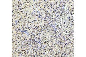 IHC analysis of PTBP1 using anti-PTBP1 antibody (ABIN7599451). (PTBP1 antibody  (AA 1-504))
