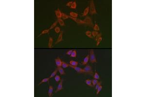 Immunofluorescence analysis of NIH/3T3 cells using HSP47/SERPINH1 Rabbit pAb  at dilution of 1:100 (40x lens). (SERPINH1 antibody)