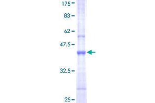 UBR1 Protein (AA 2-100) (GST tag)