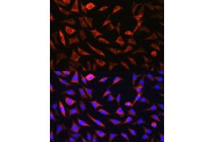 Immunofluorescence analysis of L929 cells using SLC25 antibody (ABIN7270436) at dilution of 1:100. (SLC25A22 antibody  (AA 128-188))