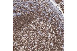 Immunohistochemical staining of human tonsil with THAP7 polyclonal antibody  shows strong nuclear positivity in squamous epithelial cells, reaction center cells and lymphoid cells outside reaction centra.