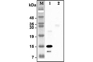 Western blot analysis of recombinant human CTRPs using anti-CTRP5 (human), pAb  at 1:4,000 dilution. (CTRP5 antibody)