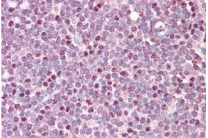 Human Tonsil: Formalin-Fixed, Paraffin-Embedded (FFPE) (CDCA5 antibody  (AA 110-159))