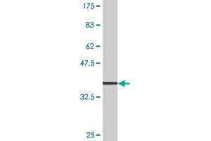 Western Blot detection against Immunogen (32. (SLC11A2 antibody  (AA 1-65))