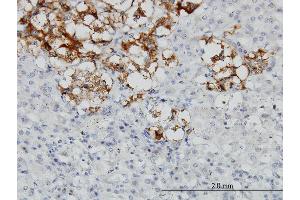 Immunoperoxidase of monoclonal antibody to DCN on formalin-fixed paraffin-embedded human adrenal gland. (Decorin antibody  (AA 1-359))