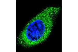 Confocal immunofluorescent analysis of COL21A1 Antibody (N-term) (ABIN656084 and ABIN2845430) with HepG2 cell followed by Alexa Fluor 488-conjugated goat anti-rabbit lgG (green).