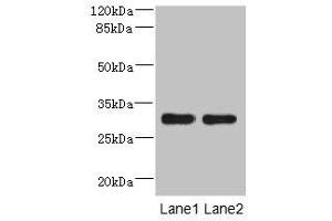 Western blot All lanes: DRAM2 antibody at 3. (DRAM2 antibody  (AA 182-266))