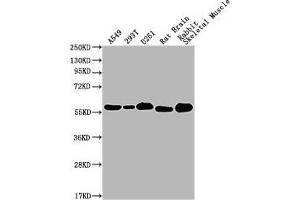 Western Blot Positive WB detected in: A549 whole cell lysate, 293T whole cell lysate, U251 whole cell lysate, Rat Brain tissue, Rabbit Skeletal Muscle tissue All lanes: PKM antibody at 1:1000 Secondary Goat polyclonal to Mouse IgG at 1/10000 dilution Predicted band size: 58 kDa Observed band size: 58 KDa Exposure time: 1 min (PKM antibody  (AA 2-531))