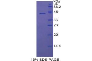 SDS-PAGE analysis of Rat Lipocalin 6 Protein. (LCN6 Protein)