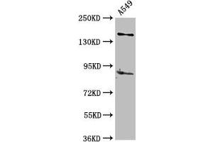 Western Blot Positive WB detected in: A549 whole cell lysate All lanes: AFF2 antibody at 5 μg/mL Secondary Goat polyclonal to rabbit IgG at 1/50000 dilution Predicted band size: 145, 141, 48, 144, 106 kDa Observed band size: 145 kDa (AFF2 antibody  (AA 575-705))
