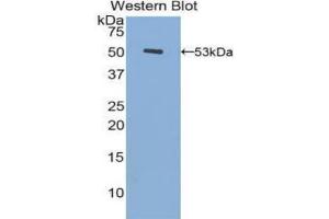 Western blot analysis of recombinant Human FGa.