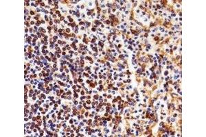 Immunohistochemical analysis of paraffin-embedded human spleen using NFKB1 antibody at 1:25 dilution. (NFKB1 antibody)