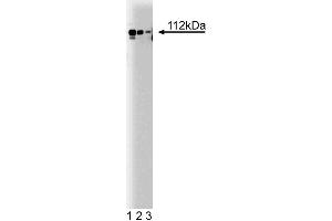 Western blot analysis of Adaptin alpha on a rat cerebrum lysate. (alpha Adaptin antibody  (AA 38-215))