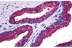 Human Prostate: Formalin-Fixed, Paraffin-Embedded (FFPE) (NPR2 antibody  (AA 131-231))