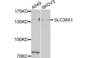 Western blot analysis of extract of A549 and SKOV3 cells, using EMILIN1 antibody. (Emilin1 antibody)