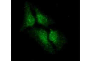 ICC/IF analysis of LSM5 in HeLa cells line, stained with DAPI (Blue) for nucleus staining and monoclonal anti-human LSM5 antibody (1:100) with goat anti-mouse IgG-Alexa fluor 488 conjugate (Green). (LSM5 antibody)