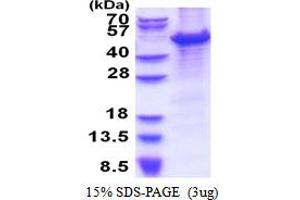 SDS-PAGE (SDS) image for Minichromosome Maintenance Complex Component 7 (MCM7) (AA 1-414) protein (His tag) (ABIN5853499) (MCM7 Protein (AA 1-414) (His tag))