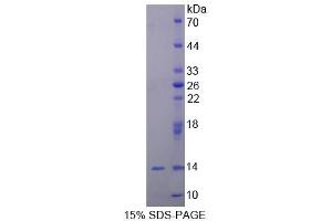 SDS-PAGE (SDS) image for Ubiquilin 2 (UBQLN2) (AA 33-126) protein (His tag) (ABIN6237192) (Ubiquilin 2 Protein (UBQLN2) (AA 33-126) (His tag))