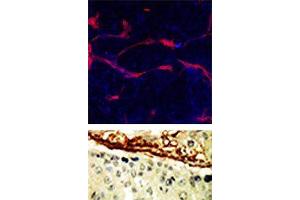 TOP: Methanol/Acetone fixed human stem cell is used in IF to detect Eph4A (blue) and endothelial Lectin(red). (EPH Receptor A4 antibody  (N-Term))