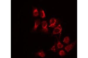 ABIN6277031 staining COLO205 by IF/ICC.