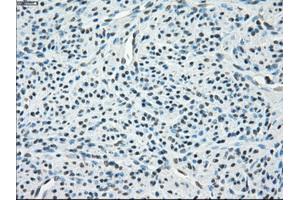 Immunohistochemical staining of paraffin-embedded endometrium tissue using anti-PPP5Cmouse monoclonal antibody. (PP5 antibody)